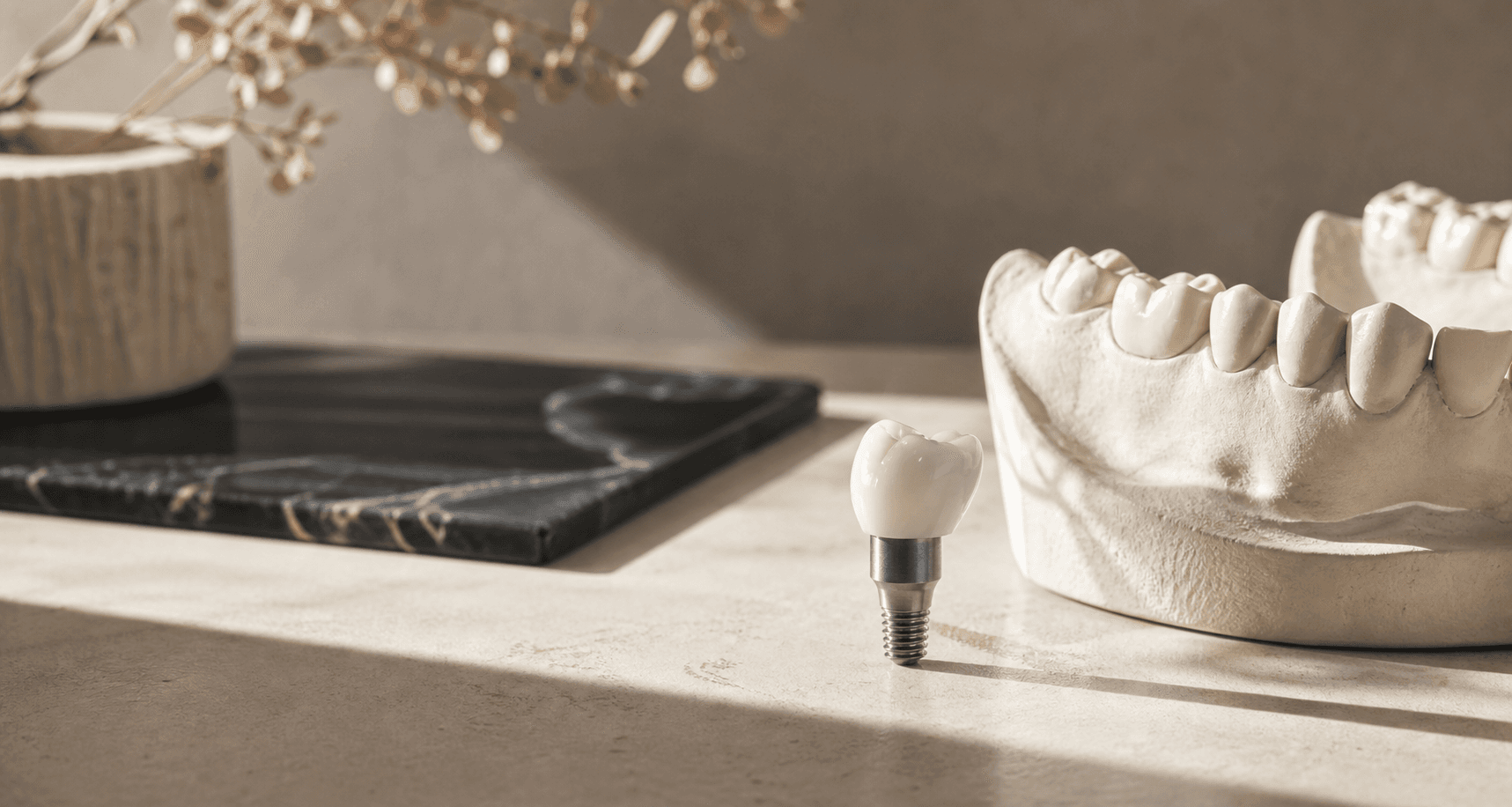 Model of a dental implant crown restoration used during a consultation at Cedarbrae Dental Center
